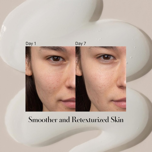 Makeup Artist Choice Lactic Acid Review Saubhaya Makeup