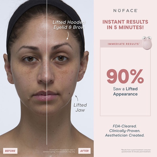 NUFACE Mini+ Starter Kit » buy online | NICHE BEAUTY