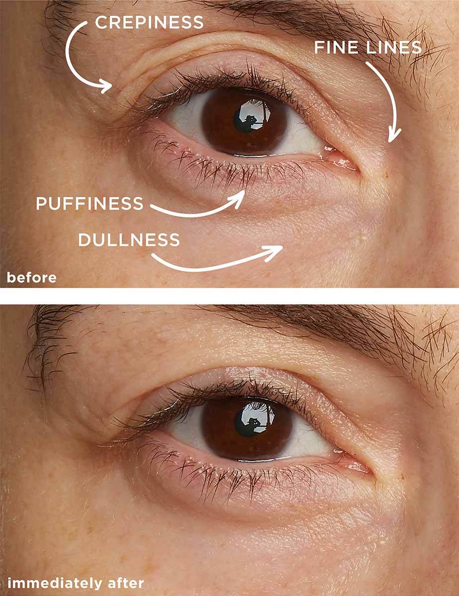 LANCER Eye Contour Lifting Cream » buy online NICHE BEAUTY