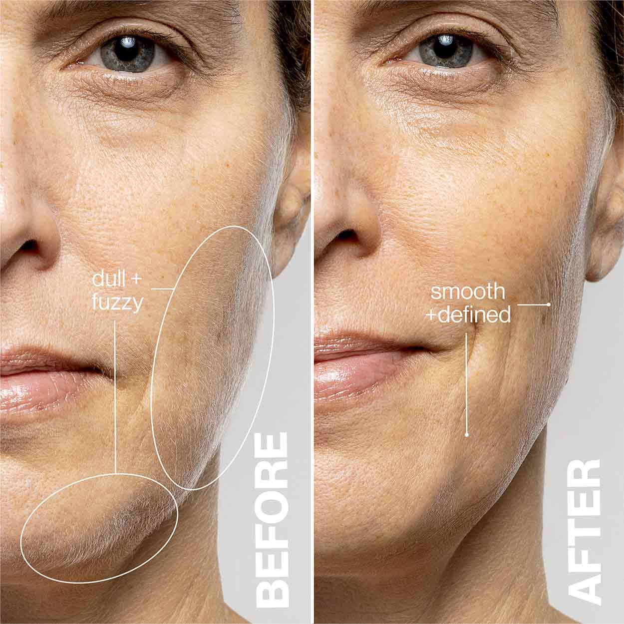 DERMAFLASH DERMAFLASH LUXE+ Advanced Sonic Dermaplaning + Peach Fuzz