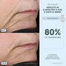 NuFace NuFACE TRINITY® ELE Effective Lip & Eye Attachment